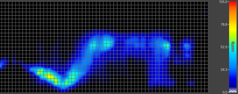 Pressure map of an average-weight side-sleeper on a Saatva Latex Hybrid.