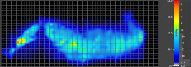 Pressure map of our heavier tester side-sleeping on a Helix Dawn Mattress.