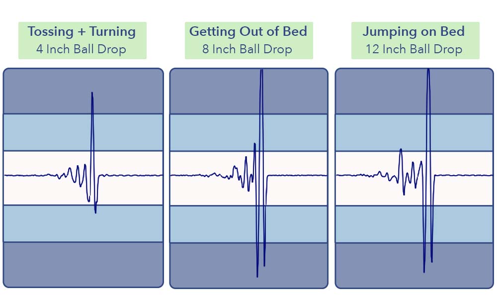 MotionTransfer Tuft NeedleHybrid