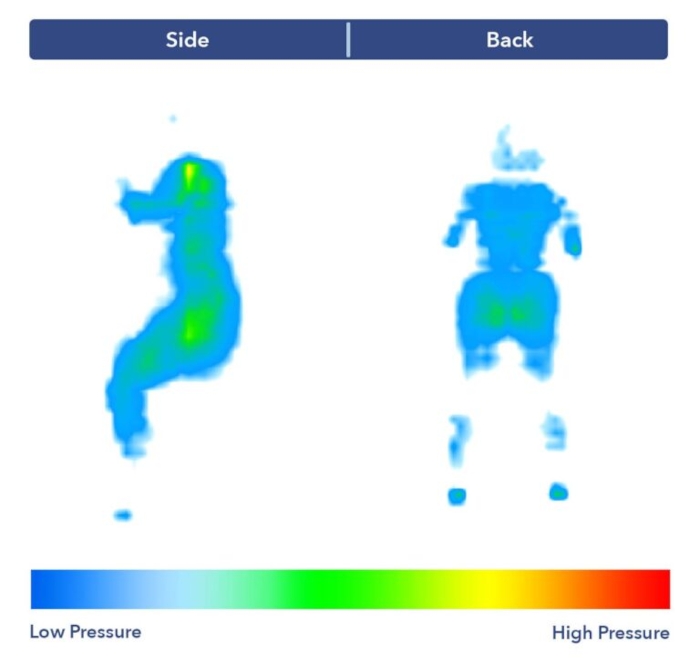 A pressure map graphic for side and back sleeping on the WinkBed original mattress. The graphic is mostly cool colors, indicating low pressure.