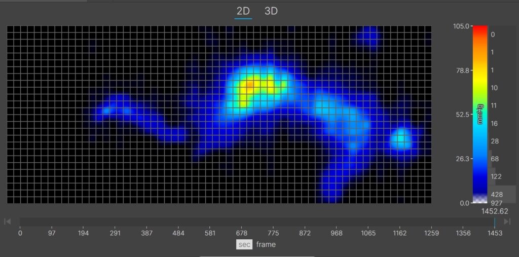A thermal graphic showing a lightweight mattress tester resting on the WinkBed in the side-sleeping position. There's a flareup of green, yellow, and orange at the hip, indicating pressure buildup in this area.